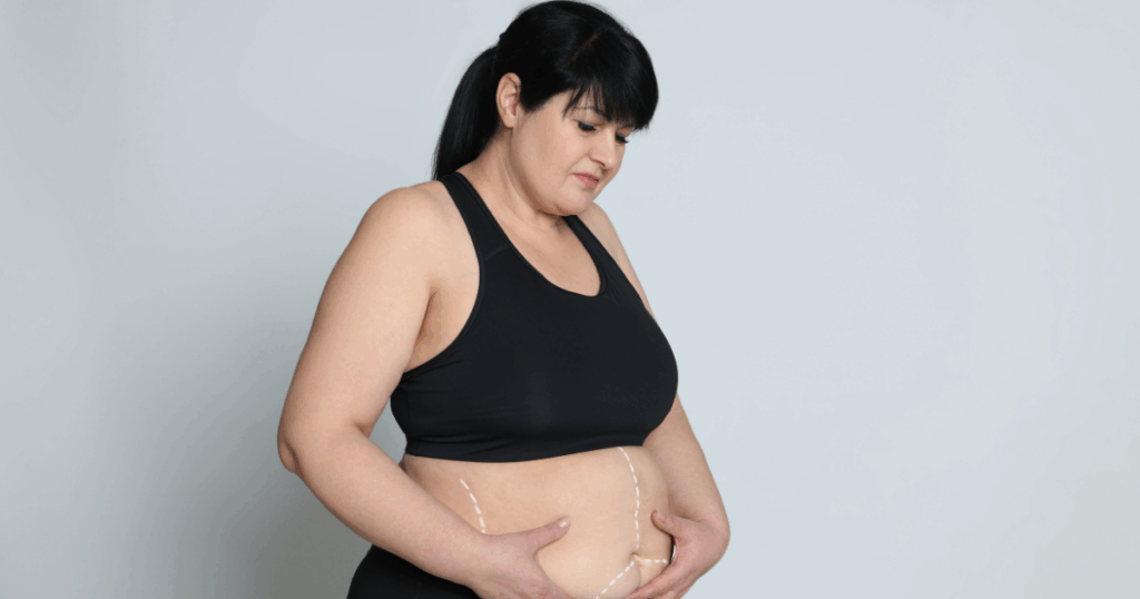中年女性の肥満体型