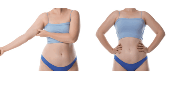 30代女性が「−5kg」を達成した、体の整え方